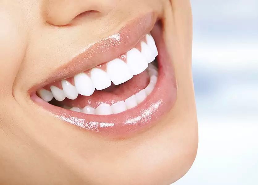 Blanqueamiento dental